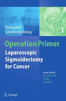 Laparoscopic Sigmoidectomy for Cancer