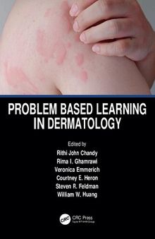 Problem Based Learning in Dermatology