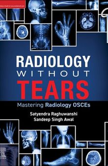 Radiology Without Tears - Mastering Radiology OSCEs (Aug 7, 2024)_(9788131269404)_(Elsevier India)