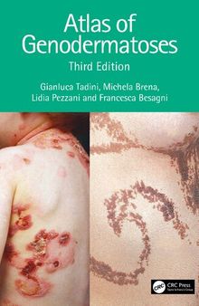 Atlas of Genodermatoses