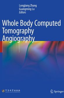 Whole Body Computed Tomography Angiography