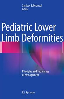 Pediatric Lower Limb Deformities: Principles and Techniques of Management