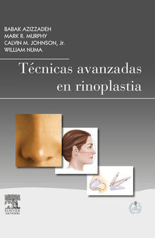 Técnicas avanzadas en rinoplastia