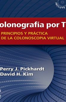 Colonografía por TC: Principios y práctica de la colonoscopia virtual