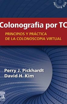 Colonografía por TC: Principios y práctica de la colonoscopia virtual