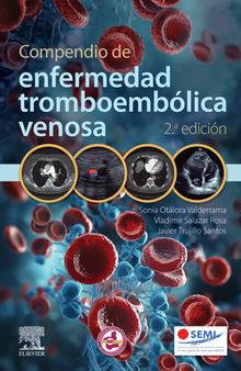 Compendio de enfermedad tromboembólica venosa