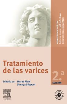 Tratamiento de las varices