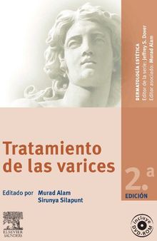 Tratamiento de las varices