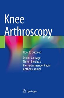 Knee Arthroscopy : How to Succeed