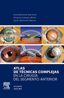 Atlas de técnicas complejas en la cirugía del segmento anterior