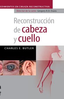 Reconstrucción de cabeza y cuello