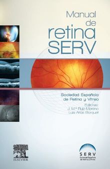 Manual de retina SERV