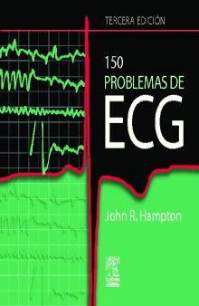 150 Problemas de ECG