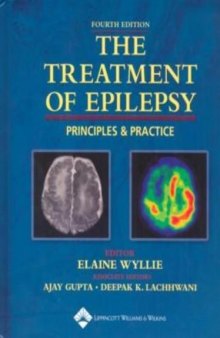 The treatment of epilepsy : principles & practice