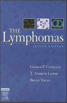 The lymphomas
