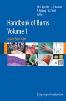 Handbook of Burns: Acute Burn Care Volume 1