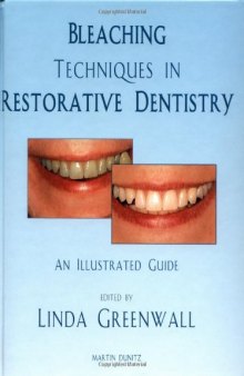 Bleaching Techniques in Restorative Dentistry  