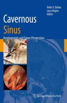 Cavernous Sinus: Developments and Future Perspectives
