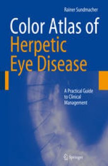 Color Atlas of Herpetic Eye Diseases: A Practical Guide to Clinical Management