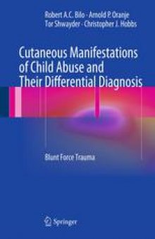 Cutaneous Manifestations of Child Abuse and Their Differential Diagnosis: Blunt Force Trauma