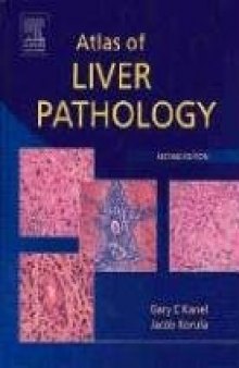 Atlas of Liver Pathology, Second Edition (ATLAS OF SURGICAL PATHOLOGY)