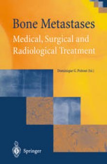 Bone Metastases: Medical, Surgical and Radiological Treatment