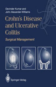 Crohn’s Disease and Ulcerative Colitis: Surgical Management