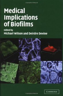 Medical Implications of Biofilms  