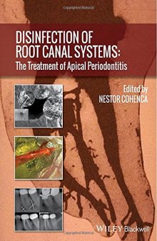 Disinfection of root canal systems : the treatment of apical periodontitis