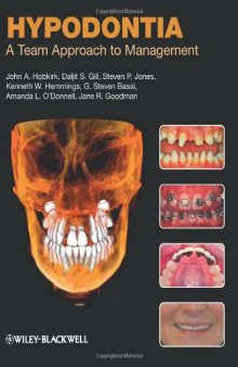 Hypodontia