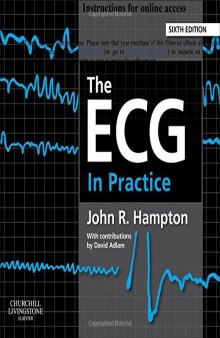 The ECG in Practice