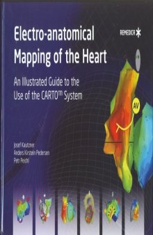 Electro-anatomical Mapping of the Heart: An Illustrated Guide to the Use of the Carto System  