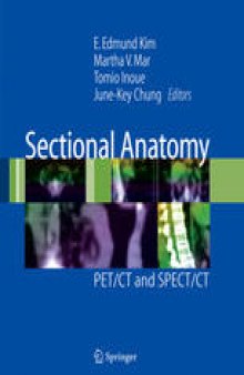Sectional Anatomy: PET/CT and SPECT/CT