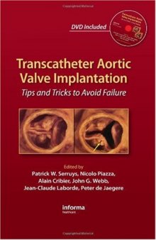 Transcatheter Aortic Valve Implantation: Tips and Tricks to Avoid Failure