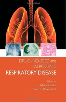 Drug Induced and Iatrogenic Lung Disease (Hodder Arnold Publication)
