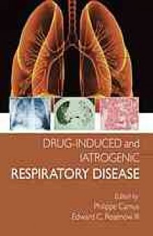 Drug-induced and iatrogenic respiratory disease