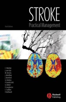 Stroke : practical management