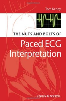 The Nuts and bolts of Paced ECG Interpretation (Nuts and Bolts Series)