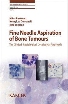 Fine Needle Aspiration of Bone Tumours: The Clinical, Radiological, Cytological Approach (Monographs in Clinical Cytology Vol 19)