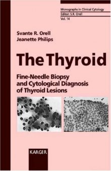 The Thyroid: Fine-Needle Biopsy and Cytological Diagnosis of Thyroid Lesions (Monographs in Clinical Cytology)