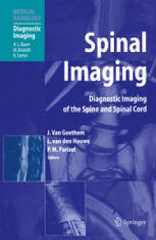 Spinal Imaging: Diagnostic Imaging of the Spine and Spinal Cord