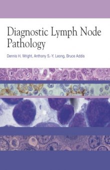 Diagnostic Lymph Node Pathology (Hodder Arnold Publication)