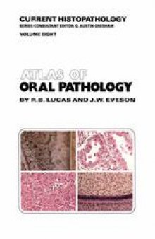 Atlas of Oral Pathology