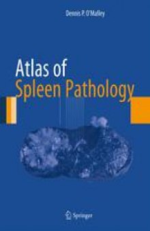 Atlas of Spleen Pathology
