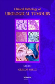 Clinical Pathology of Urological Tumors  