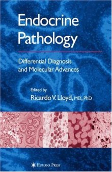 Endocrine Pathology: Differential Diagnosis and Molecular Advances