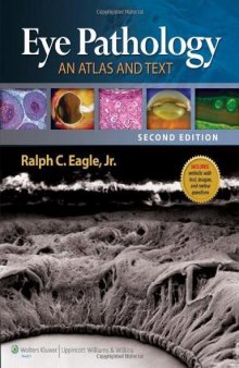 Eye Pathology An Atlas and Text second edition