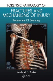 Forensic Pathology of Fractures and Mechanisms of Injury : Postmortem CT Scanning