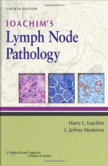 Ioachim’s Lymph Node Pathology