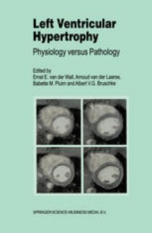 Left Ventricular Hypertrophy: Physiology versus Pathology